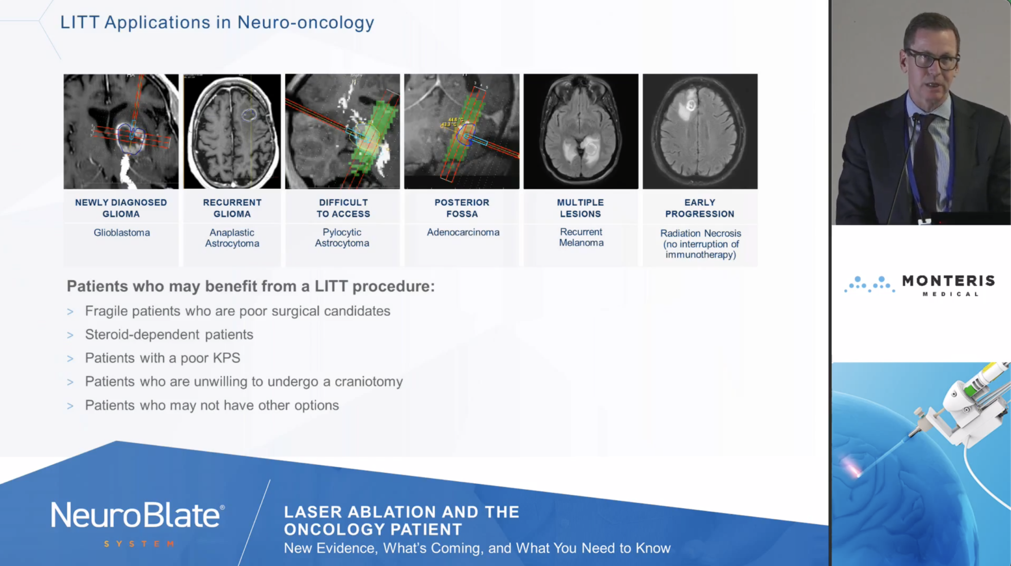 NeuroBlate Workflow – NeuroBlateEdX